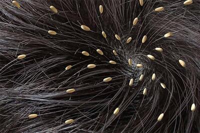 روش صحیح شستشوی شونه و برس برای جلوگیری از انگلهای پوست+فیلم - سبک ایده آل