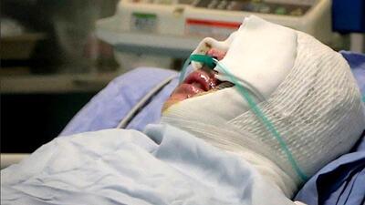 اسید پاشی  روی صورت خانم ناظم مدرسه درکرج ! / داخل مدرسه رخ داد