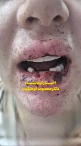 ویدیو| شلیک پدرشوهر به دهان عروس؛ شرح وضعیت مصدوم از زبان پزشک