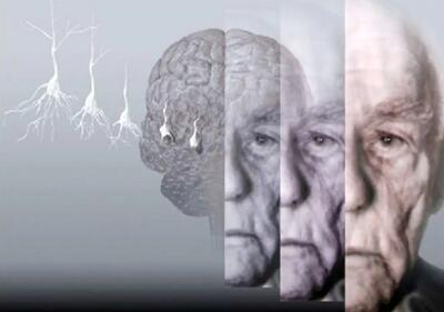 ۵ روش برای حفظ عملکرد مغز
