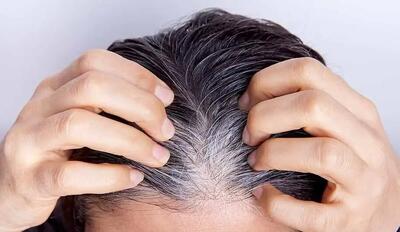 بهترین روش برای خلاصی از موخوره بدون کوتاهی مو! - سبک ایده آل
