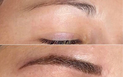 نکات و مراقبت های قبل و بعد کاشت ابرو؛ رژیم غذایی مناسبس از کاشت