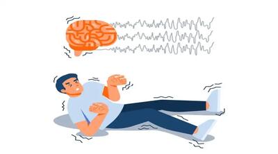 آیا تشنج‌ها زمینه ارثی دارند؟