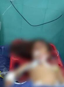 حمله سگ به کودک ۶ ساله در رفسنجان