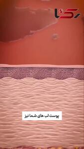 حقایق جالب درباره خشکی لب ها + فیلم