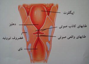 تا حالا تارهاى صوتى رو دیده بودید؟
