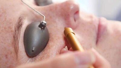 پاره شدن مویرگ زیر چشم {علت و علائم و روش های درمان}