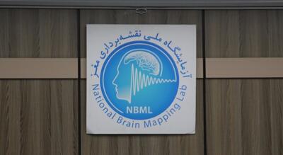 گزارش تصویری:بازدید نمایندگان و مسئولین مجلس شورای اسلامی از آزمایشگاه ملی نقشه‌برداری مغز