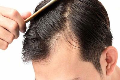 دوبار شامپو زدن موی سر درست است یا غلط؟