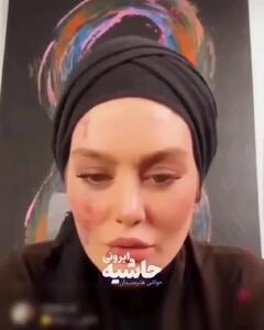 فیلم شاخ دربیار / سحر قریشی : من فقط یکبار ازدواج کردم ! / ببینید سحر قریشی چی به روز صورت زیبا و صافش آورده ! / حیف اون چهره ای که حالا اینجوری خرابش کرده!؟