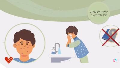 چگونه از پوست مراقبت کنیم؟ + فیلم