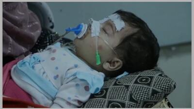 هشدار سازمان بهداشت جهانی نسبت خ شیوع سرخکان در افغانستان