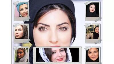 پشت پرده صنعت میلیاردی تغییر چهره؛ زنان ایرانی در آستانه یکنواختی