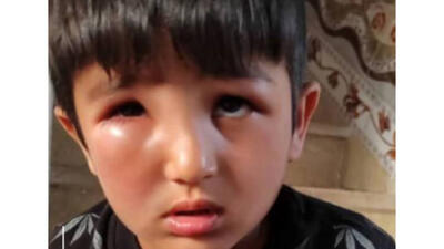 زنبورها به جان روستا افتادند / 20 نفر به روستا منتقل شدند + تصاویر