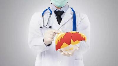 محافظ معجزه گر کبد در برابر چربی و التهاب؛ تازه بخوریم یا خشک؟