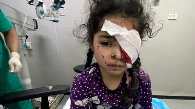 سازمان ملل متحد: حملات اسرائیل در غزه پاکسازی نژادی است