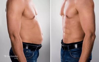 با مزو چربی سوز روند لاغریت رو سرعت بده!
