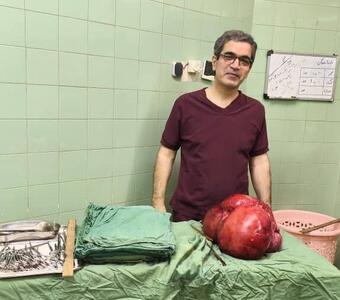 خارج‌کردن توده ۱۰ کیلویی از شکم بیمار پس از سال‌ها درد