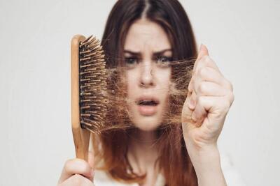 ببینید/ دلایل اصلی ریزش مو چیست ؟ | 28 اردیبهشت 1404