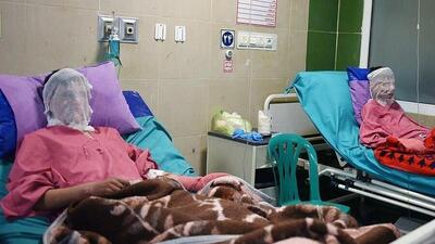 مدیرکل پزشکی قانونی:  سوختگی سال گذشته سبب مرگ ۳۰ نفر در البرز شد