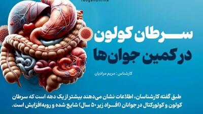 جوانان مراقب افزایش سرطان کولون باشند