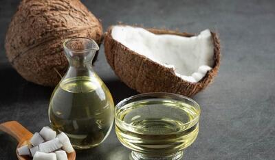 درمان طبیعی التهاب لثه با روغن نارگیل