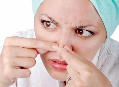 با این ترفند ساده، جوش‌های سرسیاه بینی را در خانه حذف کنید!