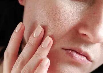 چه زمانی از یخ روی صورت استفاده کنیم؟