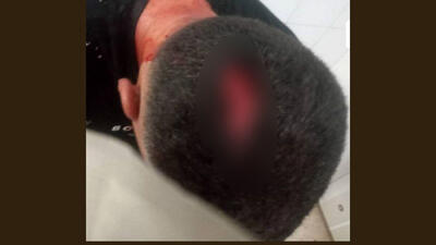 حمله خونین دستفروها به شهردارچی در مسجدسلیمان / سرش شکافته شد!