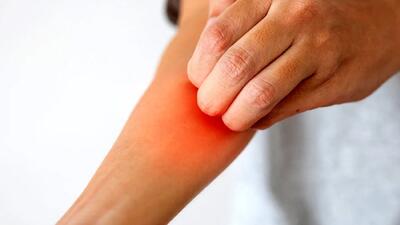 راه‌های کاهش خارش پوست بعد از اصلاح با تیغ و ژیلت