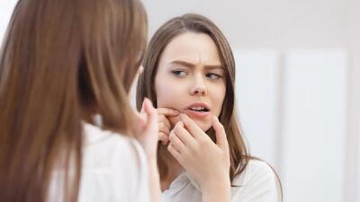5 ماسک برای جوش های سر سیاه