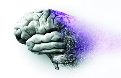 استرالیا اولین داروی درمان بیماری آلزایمر را تایید کرد