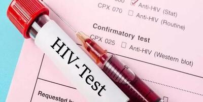 آخرین آمار مرکز تحقیقات ایدز ایران از مبتلایان به HIV