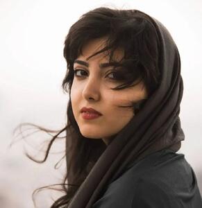 تصویر روز | چهره دیدنی زیبا کرمعلی با جذابیت خاص | گلی شی