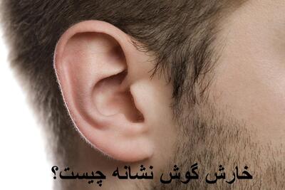 خارش گوش نشانه چیست و چه علتی دارد؟ بهترین قطره و پماد برای خارش گوش