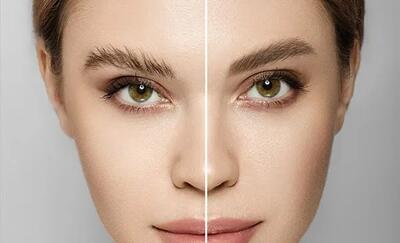 آنالیز تخصصی کاشت ابرو با روش‌های FUE و Micrograft