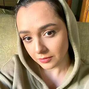 ترانه علیدوستی بدون روتوش؛ چهره‌ای که غافلگیرتان می‌کند+ عکس