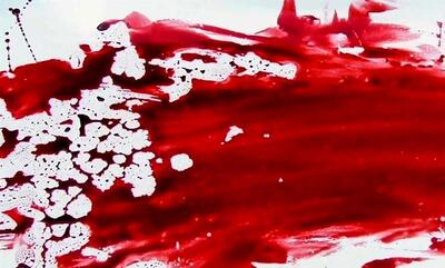 دعوای زن و شوهری به ضد و خورد چاقو چاقو شدن رسید