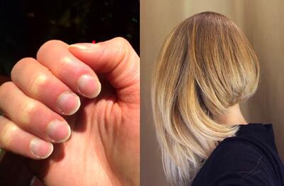 فواید سبزیجات تیره برای رشد ناخن