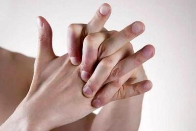 آیا شکستن قولنج منجر به آرتروز می‌شود؟/ بررسی علمی خطرات و باورهای رایج