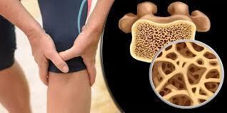 با این روش از ابتلا به پوکی استخوان فرار کنید