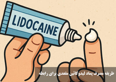 طریقه مصرف پماد لیدوکائین مقعدی برای رابطه | پماد لیدوکائین بعد از چند دقیقه اثر میکند؟
