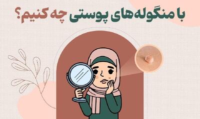 با منگوله‌های پوستی چه کنیم؟(اینفوگرافی)