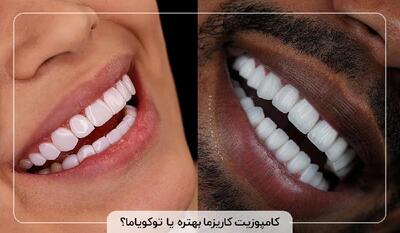 کامپوزیت کاریزما بهتره یا توکویاما؟ |  انصاف نیوز