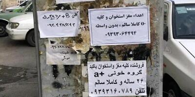 ماهی ۷۰ میلیون هزینه درمان بدون بیمه و حمایت/ خواستم کلیه‌ام را بفروشم نشد.....