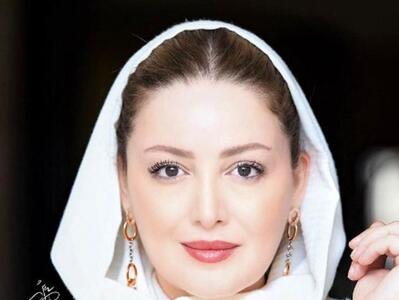 عکس لو رفته از شیلا خداداد قبل از عمل دماغ+ تصویر