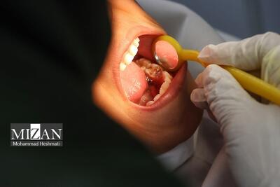 امکان بهره‌مندی ۱۰ گروه از بیماران خاص از خدمات دندان‌پزشکی