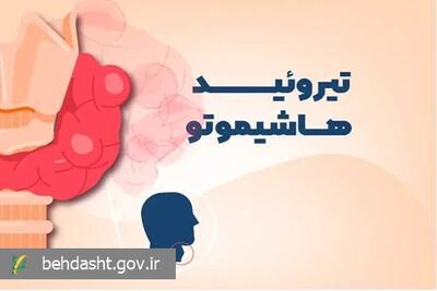 خستگی مزمن و افزایش وزن؟/ شاید شما هم مبتلا به هاشیموتو هستید!