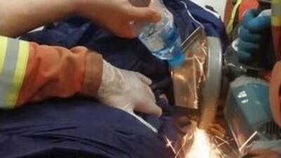 سقوط کارگر جوان بر روی میلگرد در کارگاه ساختمانی/ مصدومیت شدید با ورود میلگرد به بدن