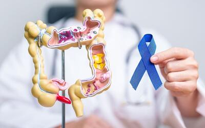 همه چیز درباره سرطان روده بزرگ/ علائم، مراحل گسترش خطر، علل و انواع درمان